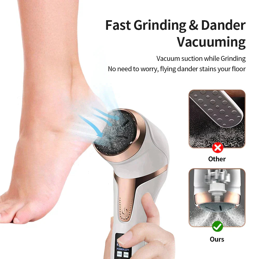 Electric Foot Callus Remover Foot Care Tool